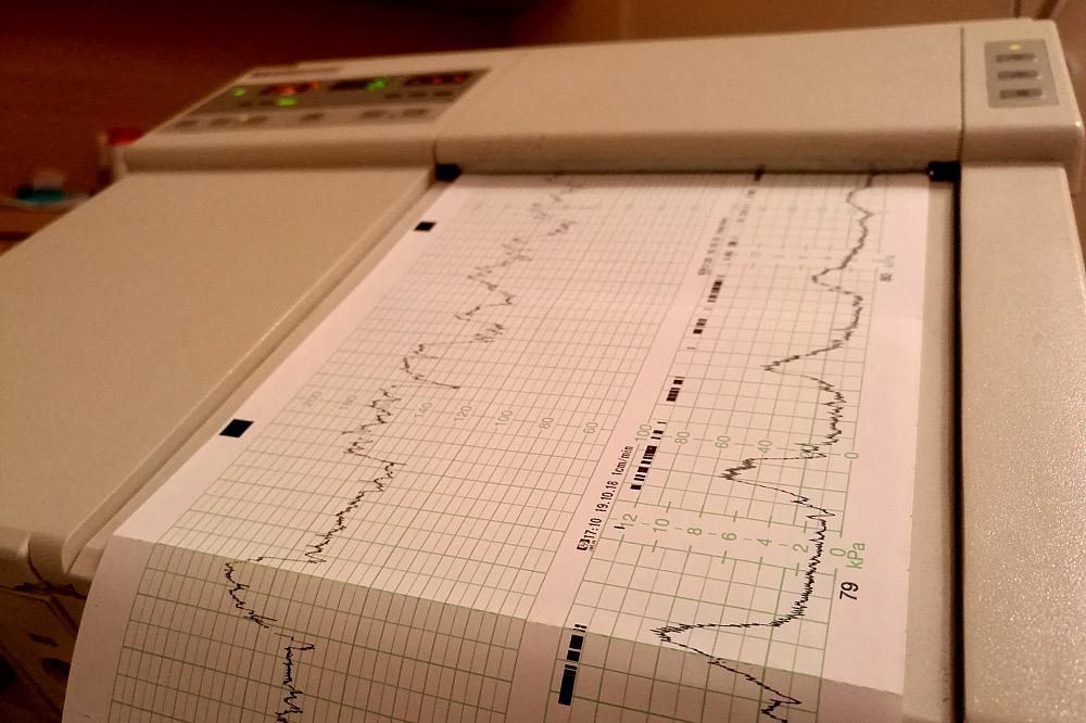 Kardiotokografie im Krankenhaus