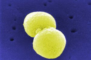 Streptococcus pneumoniae (Archiv)